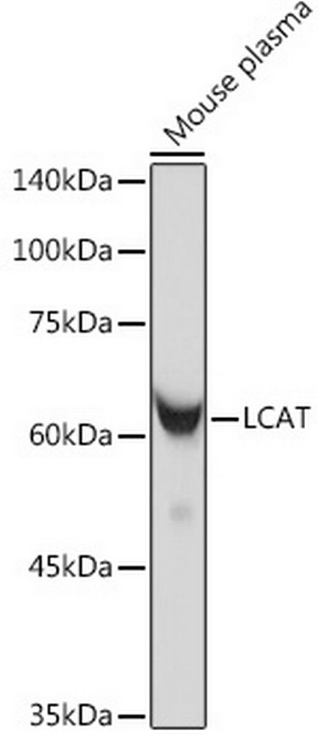 LCAT Antibody in Western Blot (WB)