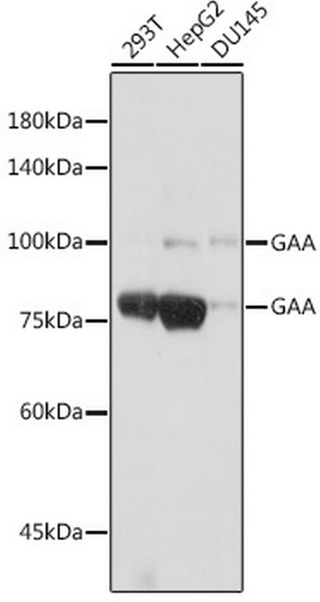 GAA Antibody in Western Blot (WB)