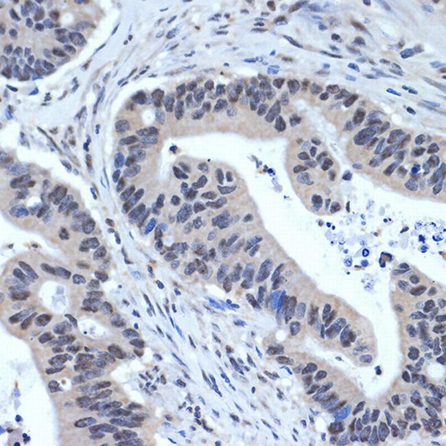 XPD Antibody in Immunohistochemistry (Paraffin) (IHC (P))