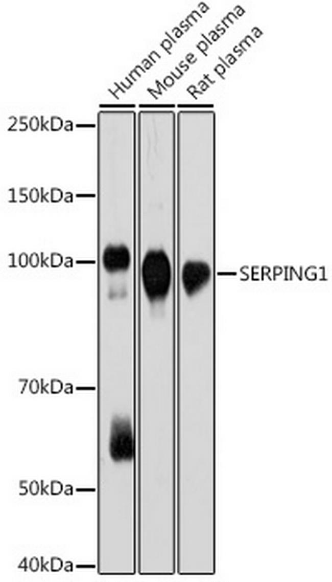 C1 inhibitor Antibody in Western Blot (WB)