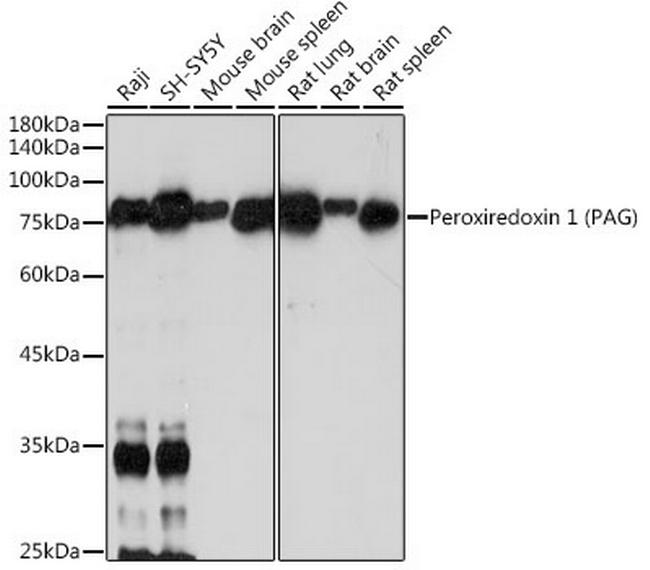 PAG1 Antibody in Western Blot (WB)