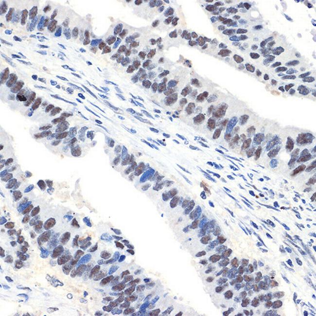 NAT10 Antibody in Immunohistochemistry (Paraffin) (IHC (P))