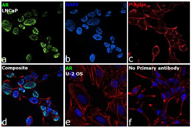 Androgen Receptor Antibody in Immunocytochemistry (ICC/IF)