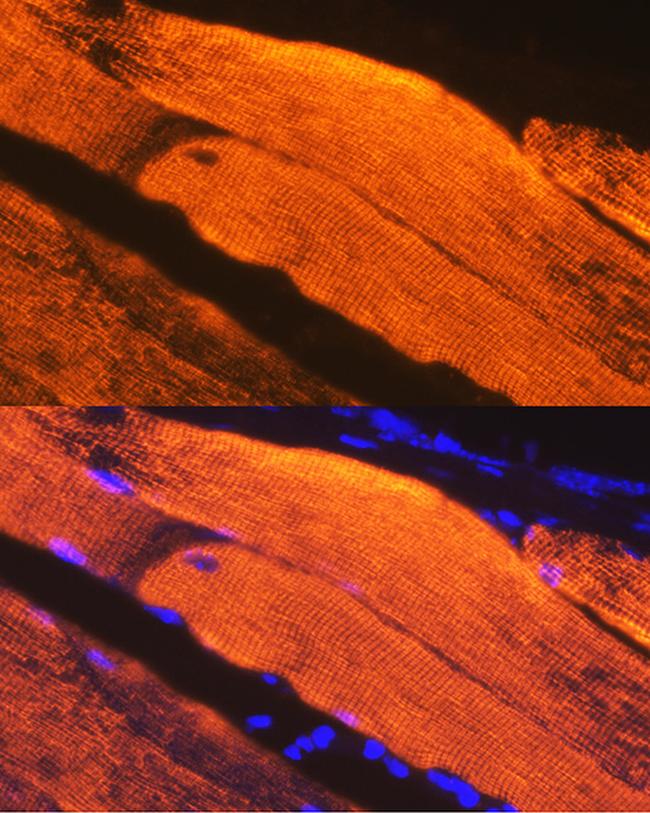 Calsequestrin Antibody in Immunohistochemistry (Paraffin) (IHC (P))