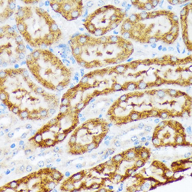 ENTPD5 Antibody in Immunohistochemistry (Paraffin) (IHC (P))