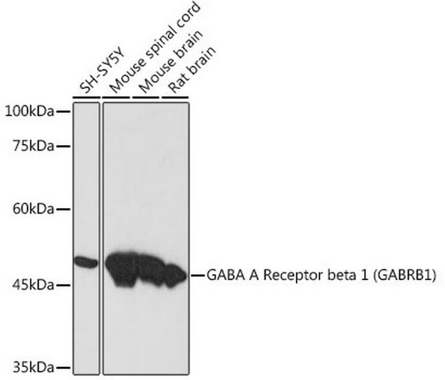 GABRB1 Antibody in Western Blot (WB)