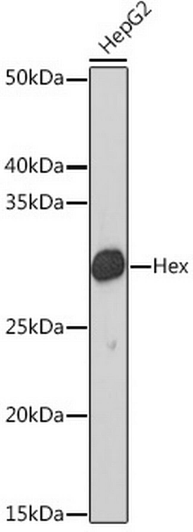 Hex Antibody in Western Blot (WB)