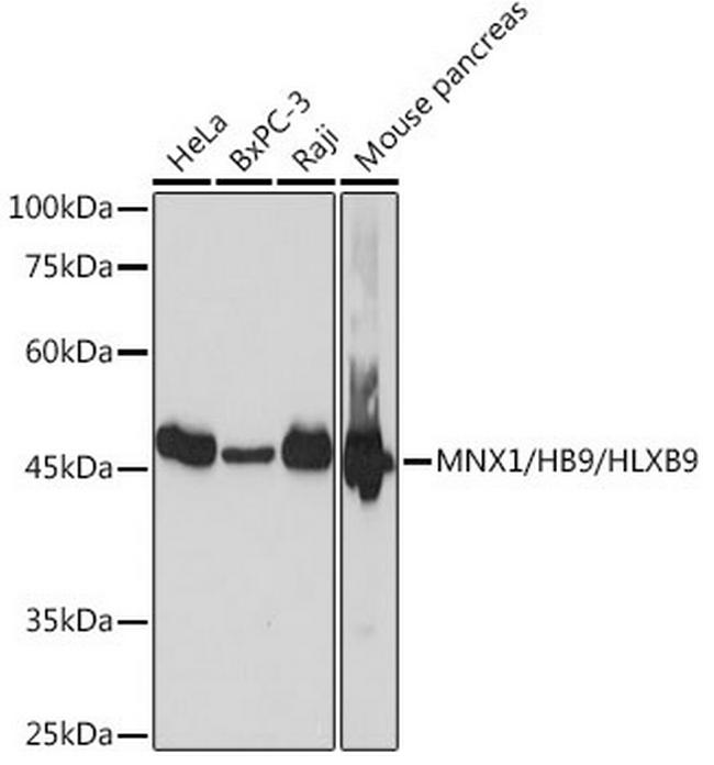 HB9 Antibody in Western Blot (WB)