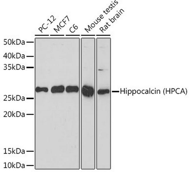 Hippocalcin Antibody in Western Blot (WB)