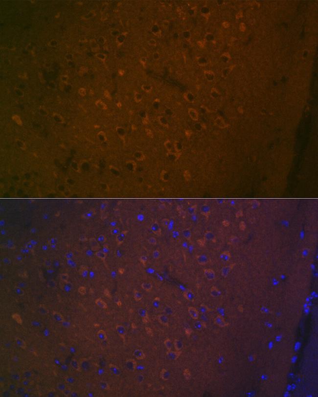 HTR7 Antibody in Immunohistochemistry (Paraffin) (IHC (P))