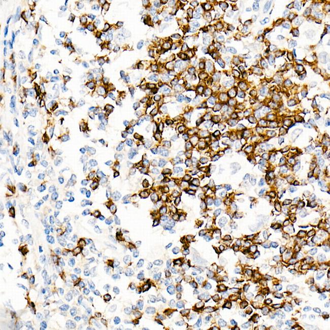 Human IgD Antibody in Immunohistochemistry (Paraffin) (IHC (P))