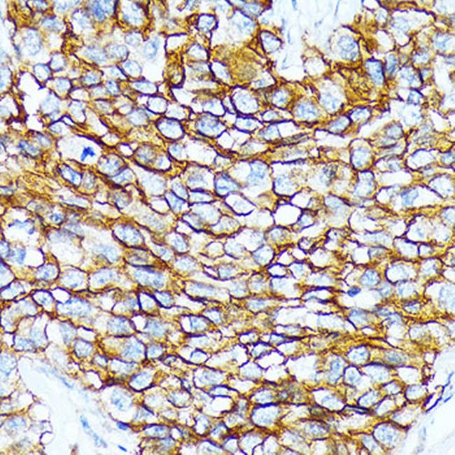 BCAM Antibody in Immunohistochemistry (Paraffin) (IHC (P))