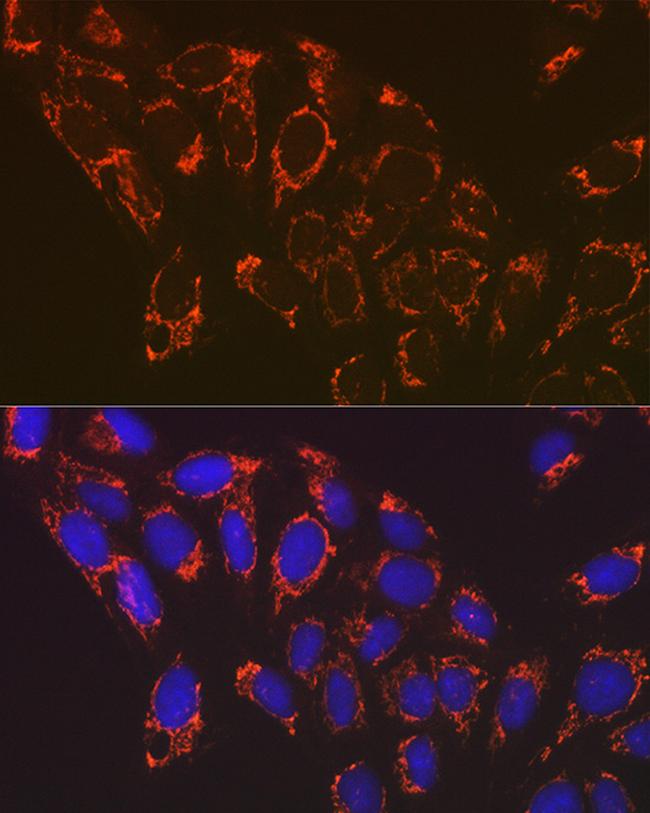 NDUFB8 Antibody in Immunocytochemistry (ICC/IF)