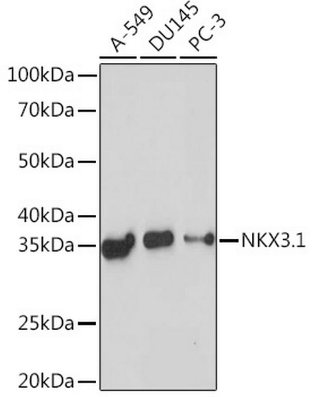 Nkx3.1 Antibody in Western Blot (WB)