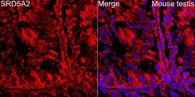 SRD5A2 Antibody in Immunohistochemistry (Paraffin) (IHC (P))