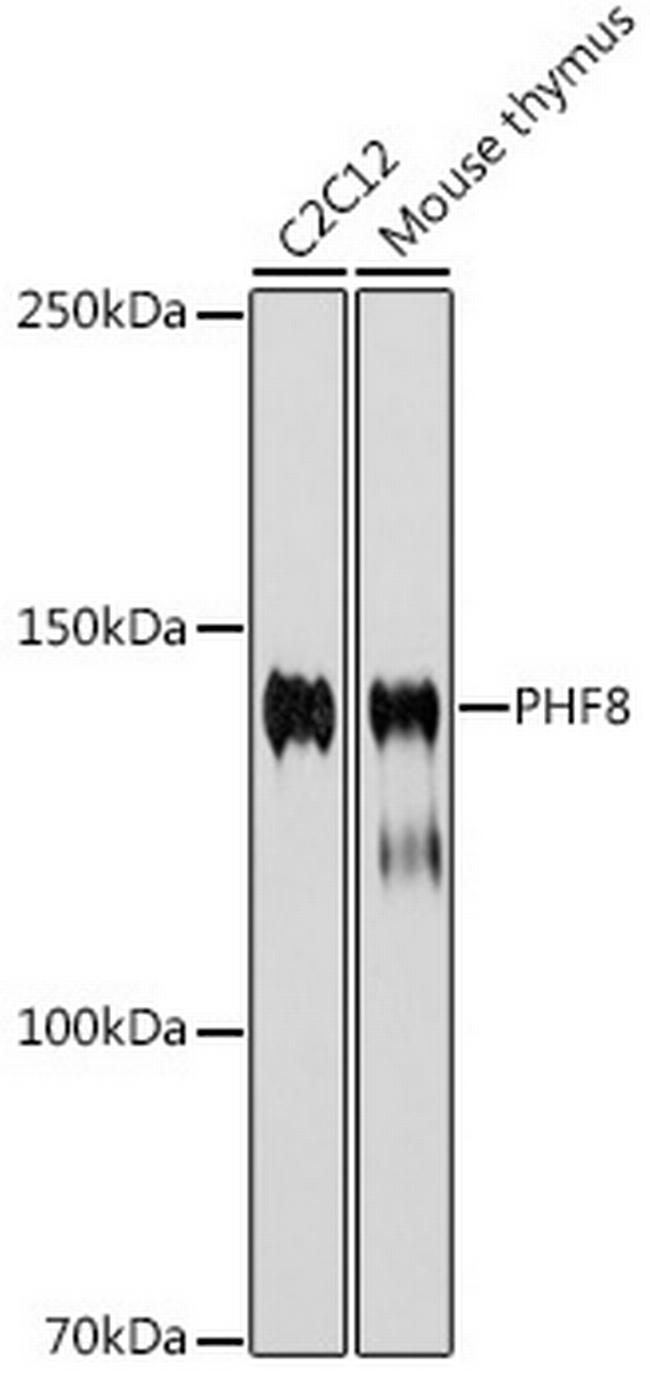 PHF8 Antibody in Western Blot (WB)