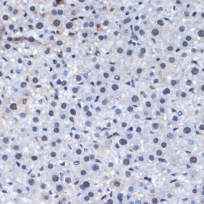 Cdc40 Antibody in Immunohistochemistry (Paraffin) (IHC (P))