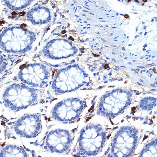 Tryptase Antibody in Immunohistochemistry (Paraffin) (IHC (P))