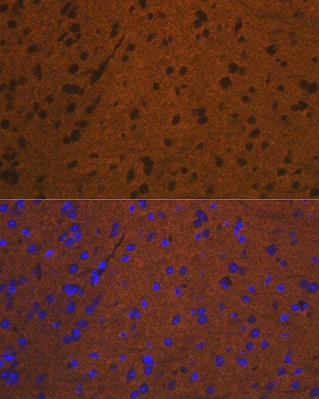 Syntaxin 1 Antibody in Immunocytochemistry (ICC/IF)