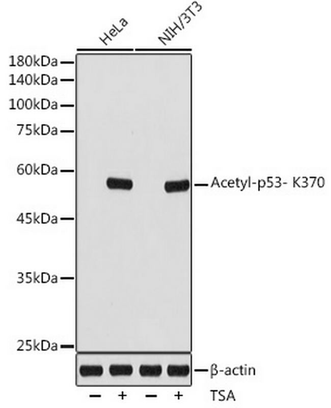 Acetyl-p53 (Lys370) Antibody in Western Blot (WB)