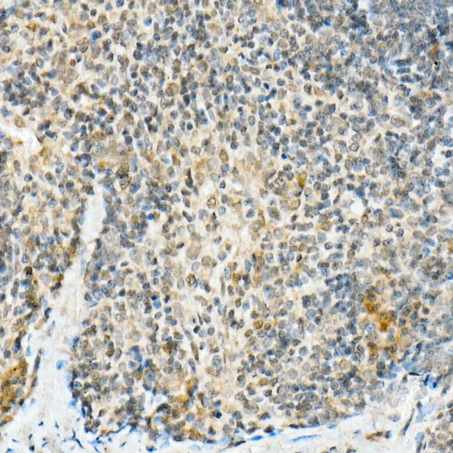 FADD Antibody in Immunohistochemistry (Paraffin) (IHC (P))