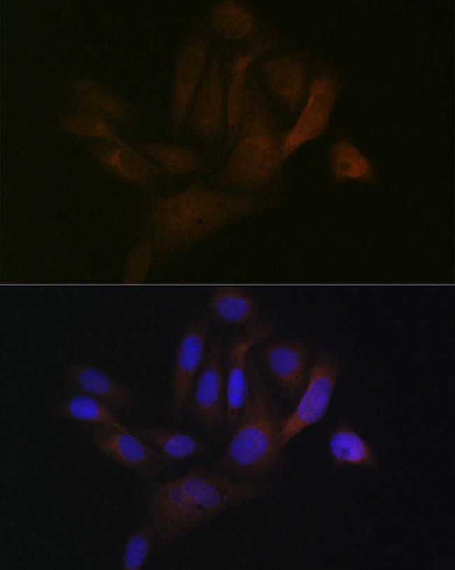 BAP31 Antibody in Immunocytochemistry (ICC/IF)