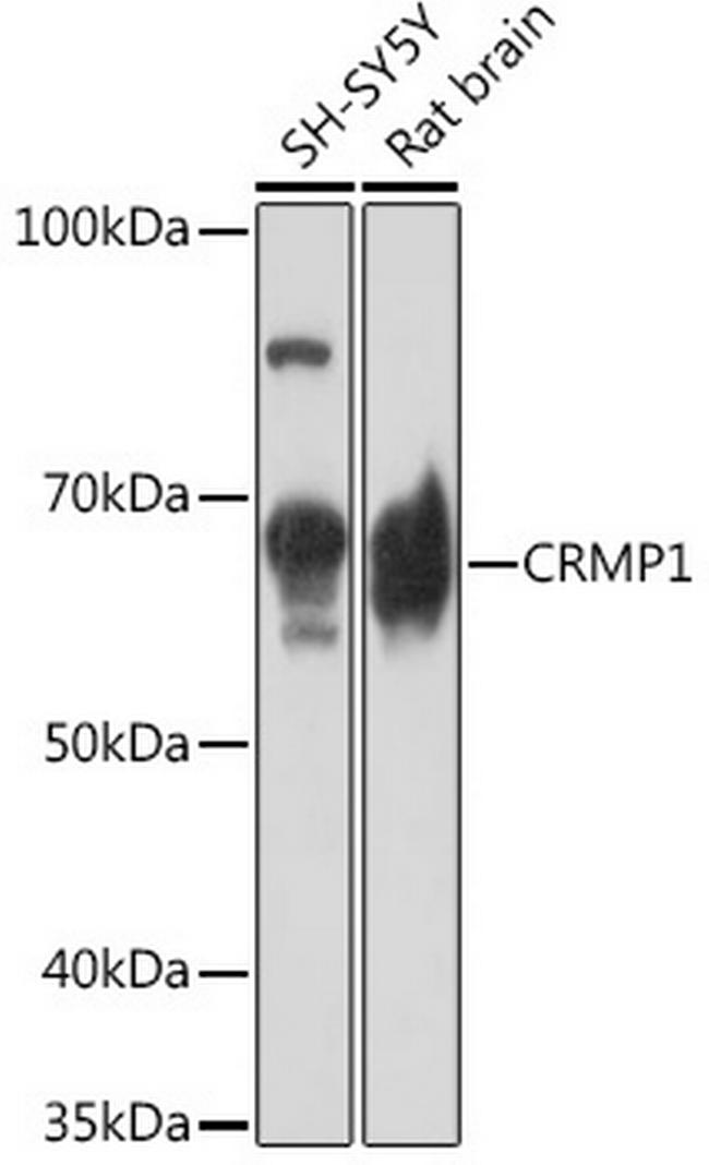 DRP1 Antibody in Western Blot (WB)