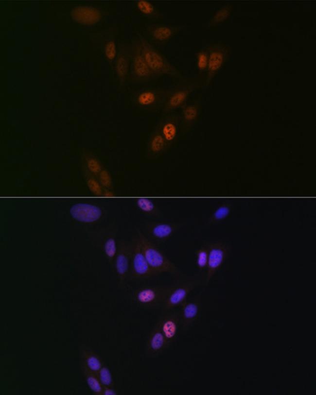 NUP153 Antibody in Immunocytochemistry (ICC/IF)