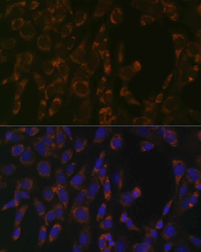 CLPP Antibody in Immunocytochemistry (ICC/IF)