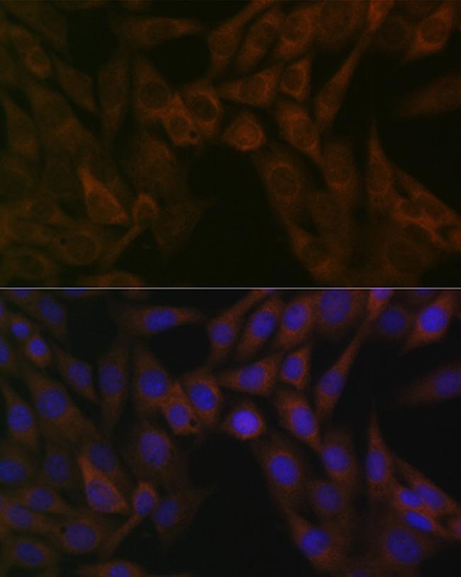 ARF5 Antibody in Immunocytochemistry (ICC/IF)