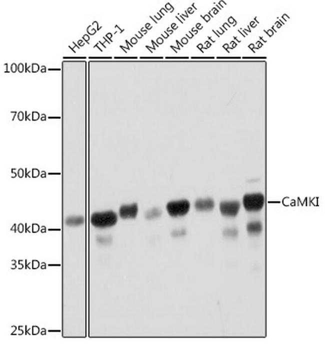 CaMKI Antibody in Western Blot (WB)