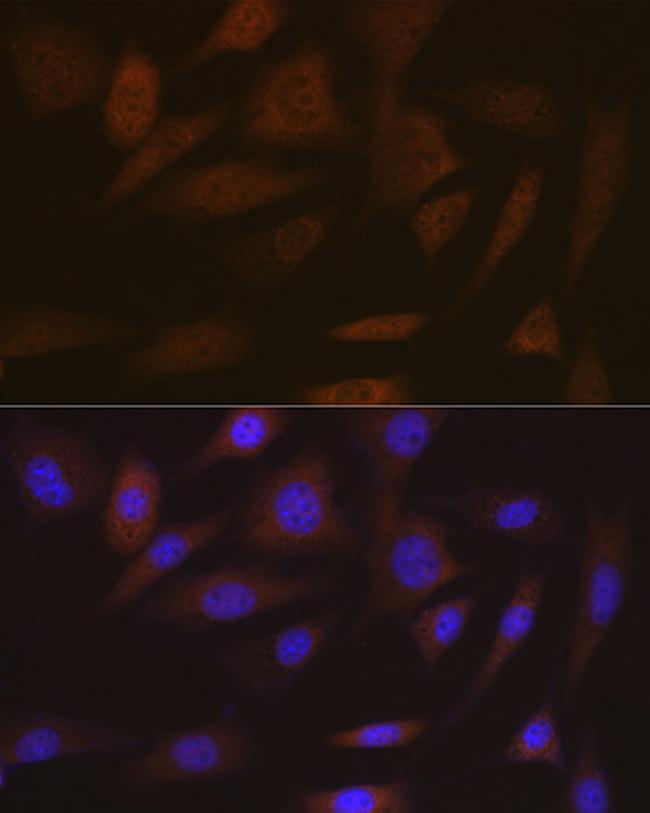 SMC4 Antibody in Immunocytochemistry (ICC/IF)