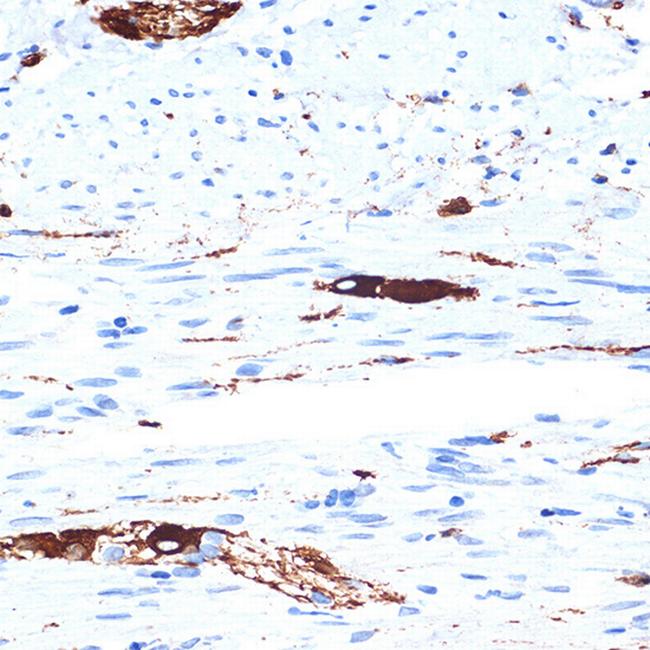 alpha Internexin Antibody in Immunohistochemistry (Paraffin) (IHC (P))