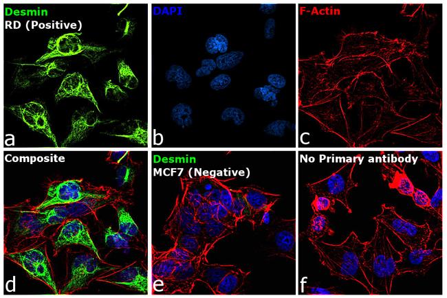 Desmin Antibody in Immunocytochemistry (ICC/IF)