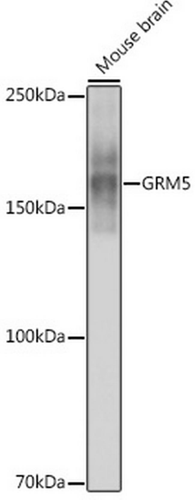 mGluR5 Antibody in Western Blot (WB)