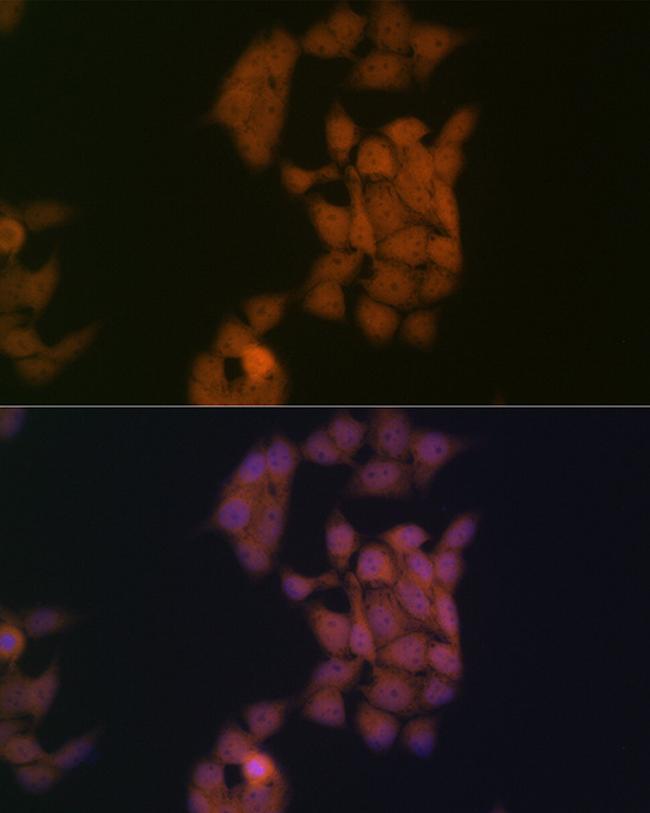 Kaiso Antibody in Immunocytochemistry (ICC/IF)