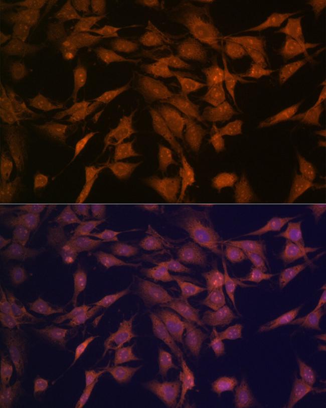 CENPC Antibody in Immunocytochemistry (ICC/IF)