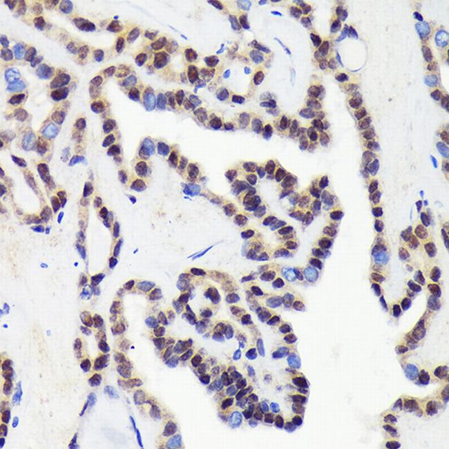 CDCA5 Antibody in Immunohistochemistry (Paraffin) (IHC (P))