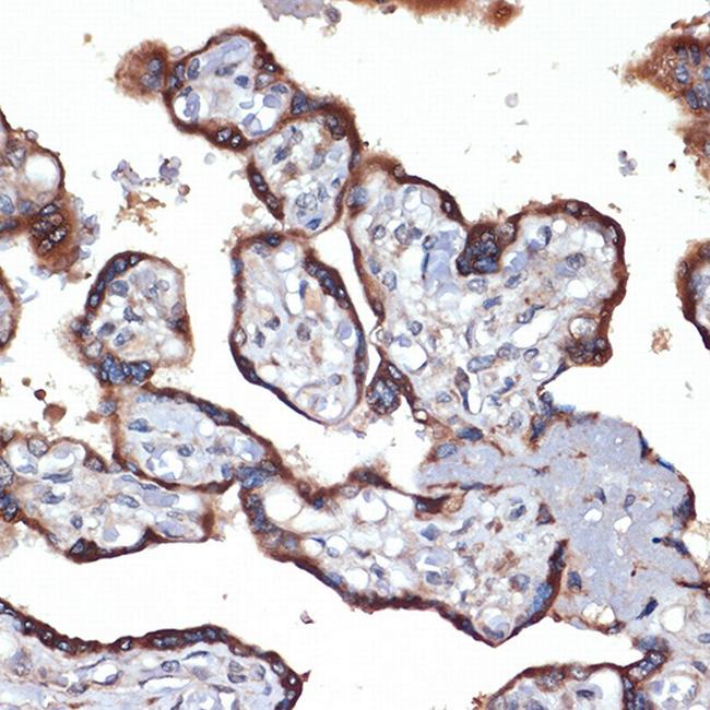 TMEFF2 Antibody in Immunohistochemistry (Paraffin) (IHC (P))