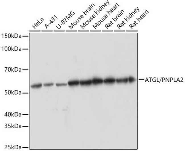 ATGL Antibody in Western Blot (WB)