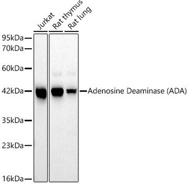 Adenosine Deaminase Antibody in Western Blot (WB)