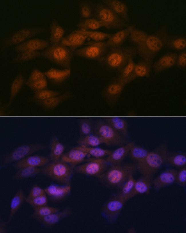 WAPL Antibody in Immunocytochemistry (ICC/IF)