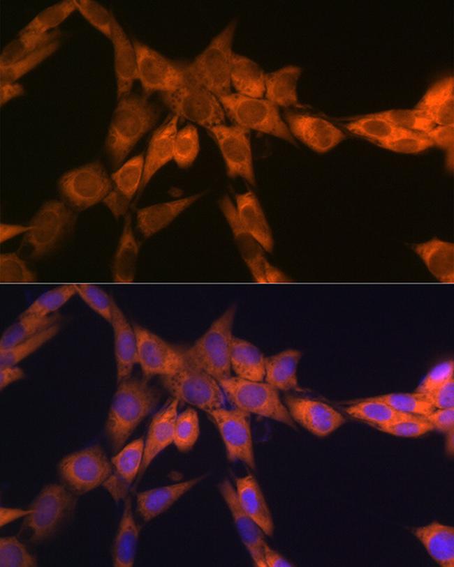 RPSA Antibody in Immunocytochemistry (ICC/IF)