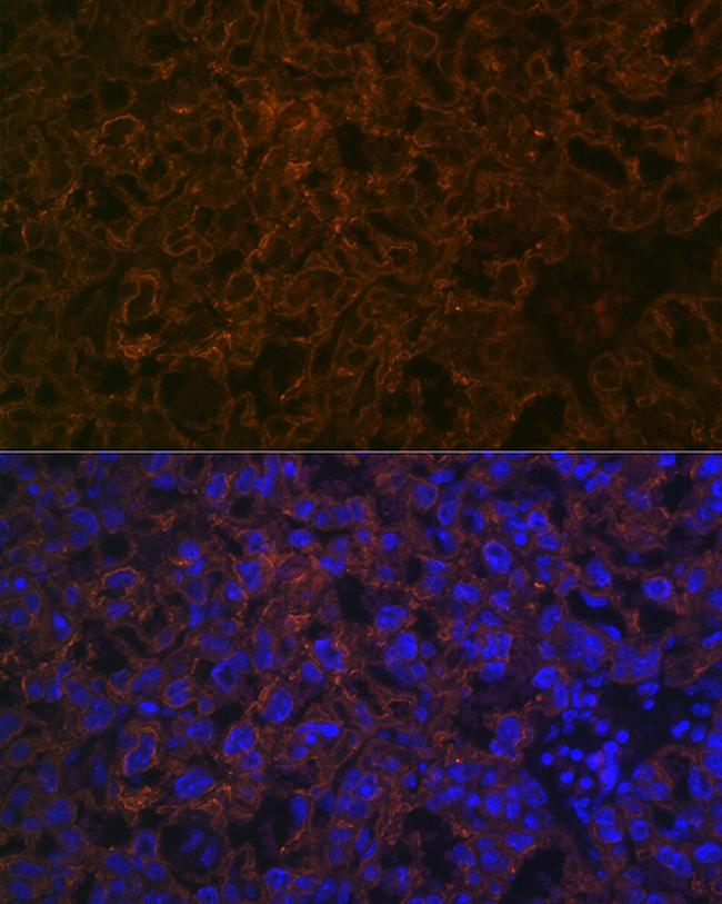 CYP26A1 Antibody in Immunocytochemistry (ICC/IF)