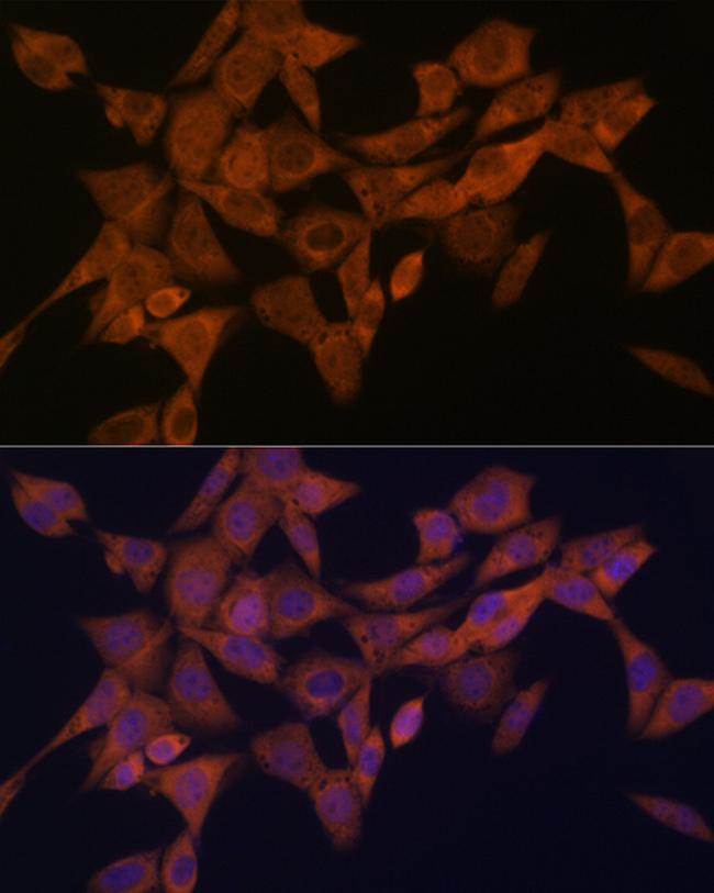 Syntaxin 4 Antibody in Immunocytochemistry (ICC/IF)