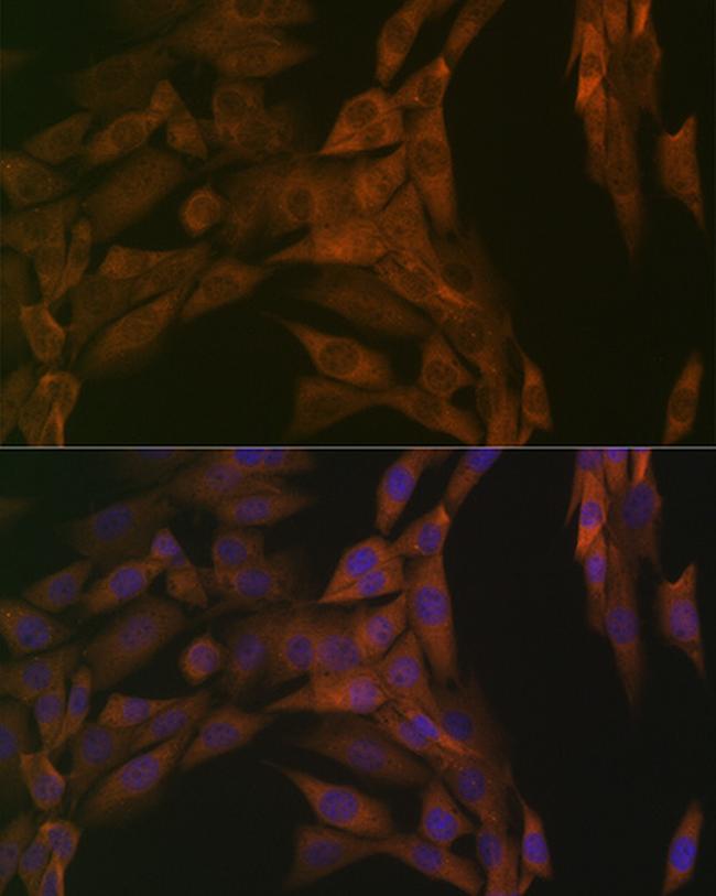 PP2A alpha/beta Antibody in Immunocytochemistry (ICC/IF)