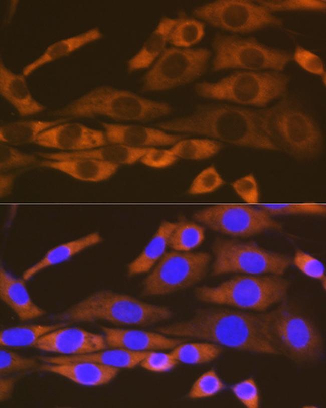 KARS Antibody in Immunocytochemistry (ICC/IF)