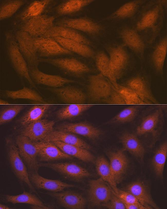 RAIDD Antibody in Immunocytochemistry (ICC/IF)