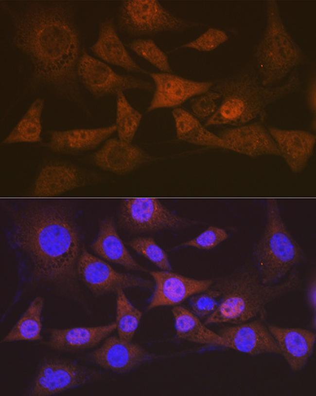 eIF2b epsilon Antibody in Immunocytochemistry (ICC/IF)