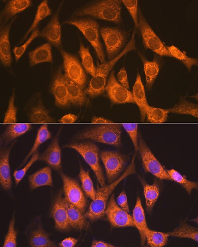 NDUFS4 Antibody in Immunocytochemistry (ICC/IF)